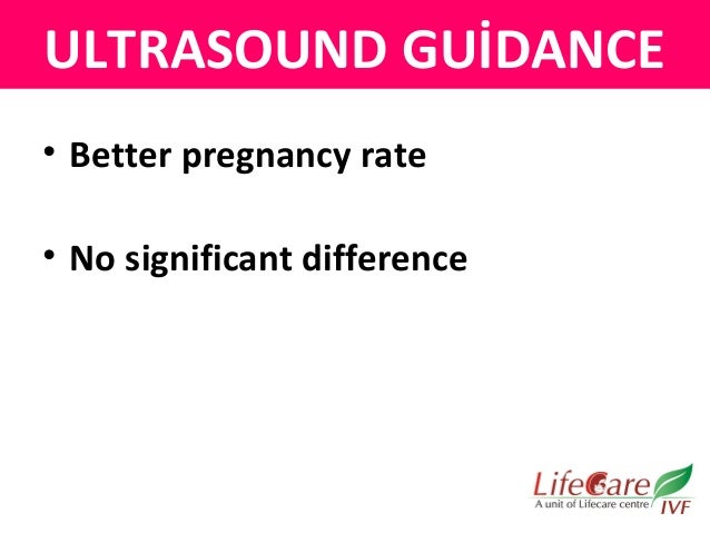 embryo transfer not ultrasound guided